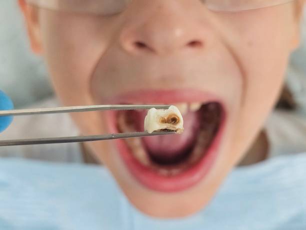 Best Emergency Pediatric Dentist  in Markham, IL