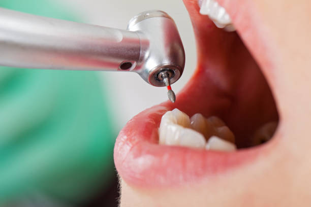 Best Knocked-Out Tooth Emergency  in Markham, IL